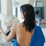 mamografías sin costo