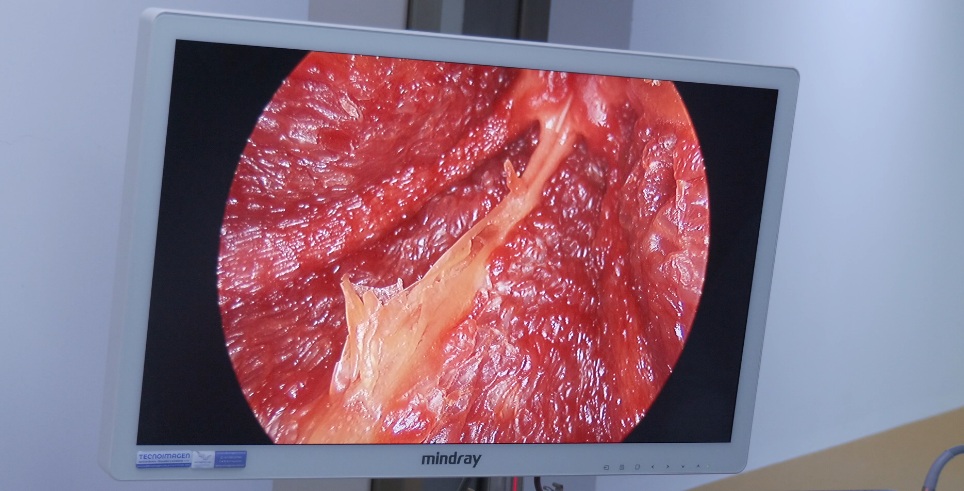 Innovación en salud: el Hospital Favaloro incorpora equipo clave para cirugías ginecológicas donado por el Rotary imagen-13